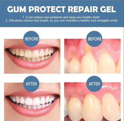 📢📢50% Off!!⏰ Teeth Whitening & Repair Gel 🦷